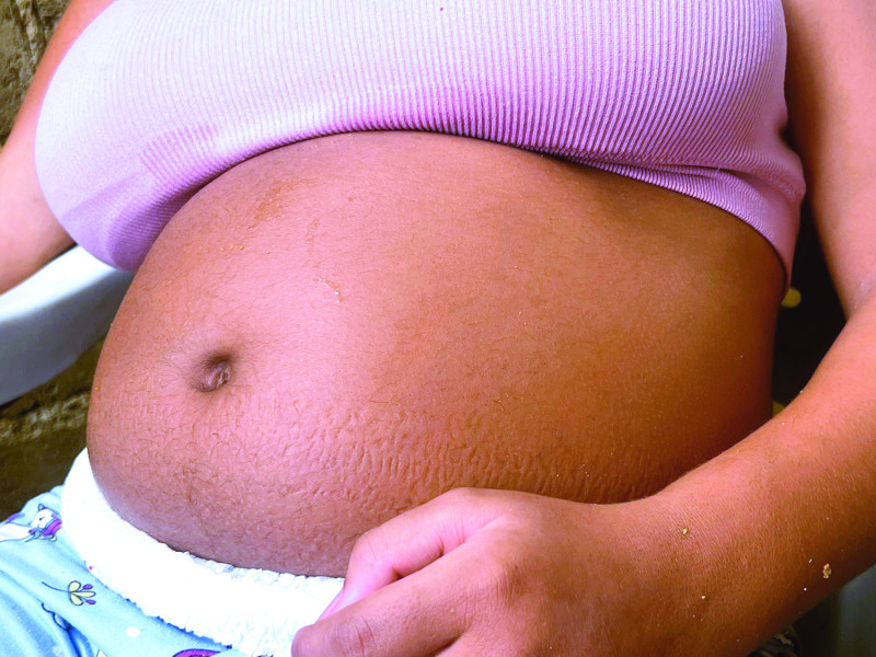 Una niña con discapacidad víctima de violación y embarazo