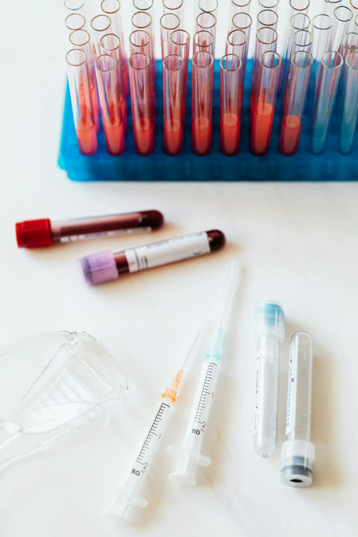 Un análisis de sangre predice el riesgo de enfermedad cardiovascular en las mujeres 30 años antes